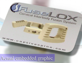http://www.phillipsmedicraft.com/wp-content/uploads/ether/DCG_CloseUp-thumb220x165.png